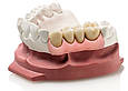 Штучна десна Gingifast Elastic (Гингифаст Еластик) А-Силікон для відтворення десни на моделі, фото 3