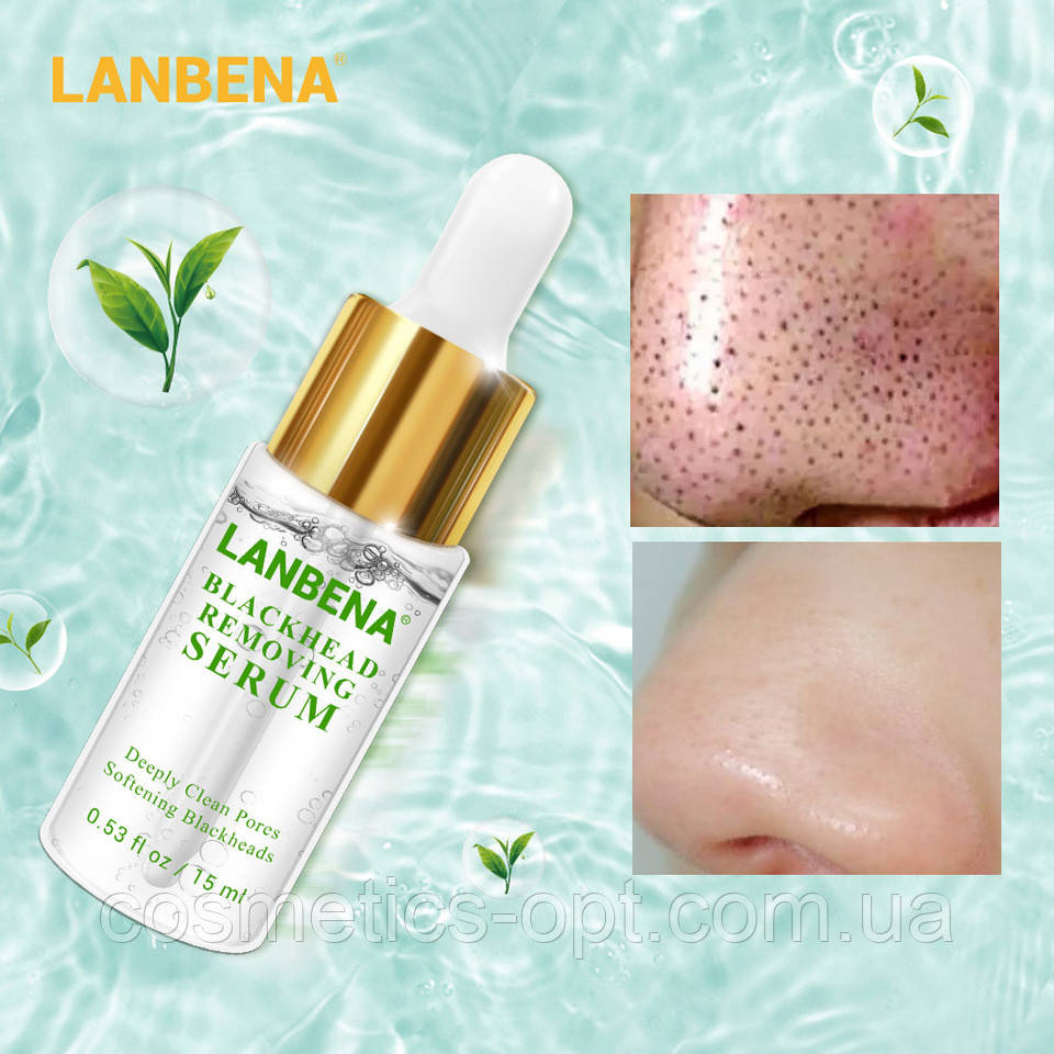 ЗАСТОСУВАННЯ КУРУХУ! Серум для видалення чорних цяток Lanbena Blackhead Removing Serum, 15 ml