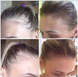 Маска проти випадіння волосся. Крок 4, фото 6