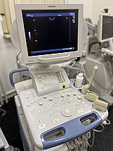 УЗД апарат TOSHIBA Nemio XG, фото 4
