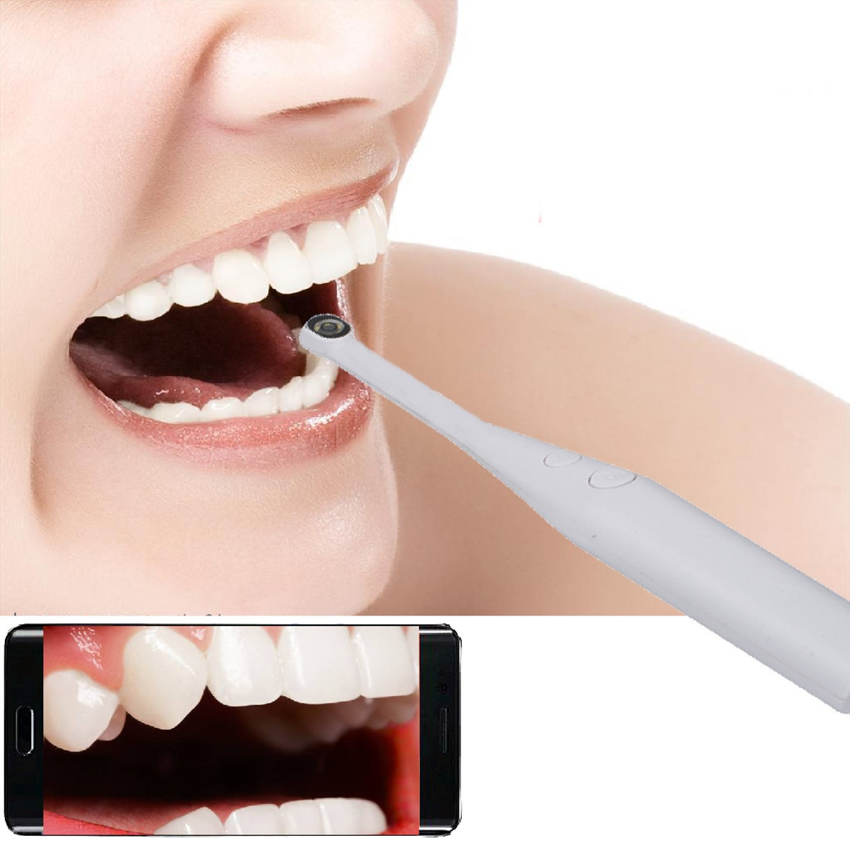 Камера стоматологическая интраоральная 2 Mpx XJ-MOUSE, 6 светодиодов, USB и Micro - фото 7 - id-p1234868349