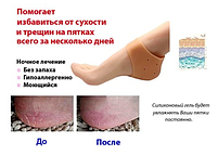 Силіконовий фіксатор для п'ят-2010, фото 4