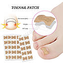 Наклейки пластир від вростання нігтів 50 шт, фото 3