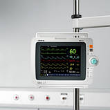 Монітор пацієнта IMEC10, фото 2