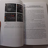Труфанов Р. Е., Рязанов Ст. Ст., Іванова Л. В. УЗД з еластографією в мамології 2013, фото 7