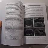 Труфанов Р. Е., Рязанов Ст. Ст., Іванова Л. В. УЗД з еластографією в мамології 2013, фото 6