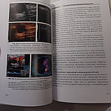 Труфанов Р. Е., Рязанов Ст. Ст., Іванова Л. В. УЗД з еластографією в мамології 2013, фото 4