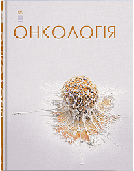 Книга "Онкологія" Шевченко А. І. та ін.