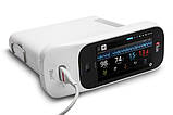 Приліжковий пульсоксиметр - Masimo Rad-97 Pulse Co-Oximeter with Noninvasive Blood Pressure, фото 4