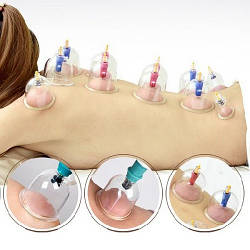 Вакуумні банки