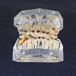 Демонстраційні моделі зубів для ортодонтів