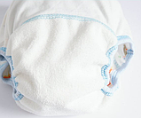 Π’ΡΠ΅Π½ΡΠ²Π°Π»ΡΠ½Ρ ΡΡΡΡΠΈ Π΄Π»Ρ ΠΏΡΠΈΠ²ΡΠ°Π½Π½Ρ Π΄ΠΎ Π³ΠΎΡΡΠΈΠΊΠ° "ΠΠΎΠΆΠ° ΠΊΠΎΡΡΠ²ΠΊΠ°", ΡΠΎΡΠΎ 2