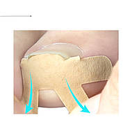 Комплект патчей для коррекции вросших ногтей, 4шт, Элластичный, дышаший, Восстановление, Коррекция, Фиксатор,