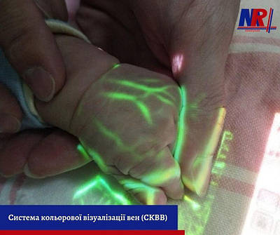 Система кольорової візуалізації вен