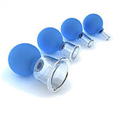 Банки сухі вакуумні полімерно-скляні діаметром 50 мм,33 мм,22 мм,11 мм,№4,,Україна, фото 2