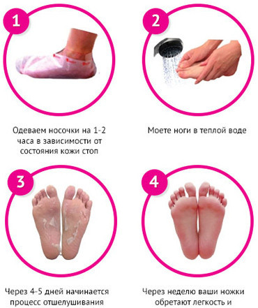 Носочки для педикюра Sosu Роза, 1 пара, носочки для пилинга в домашних условиях| шкарпетки для педикюру (GK) - фото 6 - id-p906203438