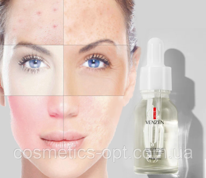 Ампульних сироватка для вирівнювання тону шкіри VENZEN Freckle Essence, 15 ml
