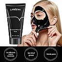Високоефективний засіб проти вугрів і чорних цяток Lanbena Black Mask, фото 3
