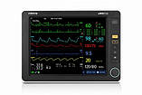 Монітор пацієнта uMEC12 (IMEC12) Медапаратура, фото 2