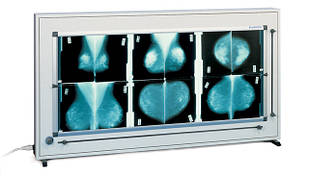 Негатоскопы