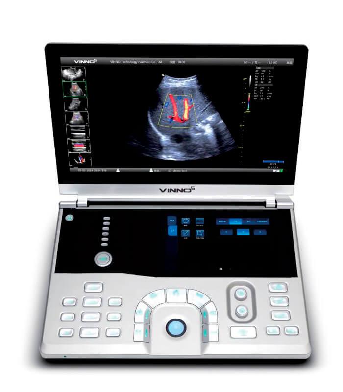 Система ультразвукової діагностики VINNO 5, фото 1