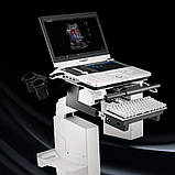 Система ультразвукової діагностики VINNO 5, фото 2