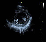 Система ультразвукової діагностики VINNO 5, фото 6