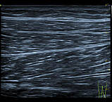 Система ультразвукової діагностики VINNO 5, фото 7