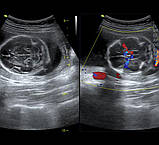 Система ультразвукової діагностики VINNO 5, фото 8