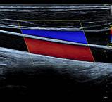 Система ультразвукової діагностики VINNO 5, фото 9