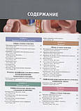 Федерли М. П. Диференціальна діагностика засобами візуалізації. Живіт і малий таз 2-е вид 2020 рік, фото 2