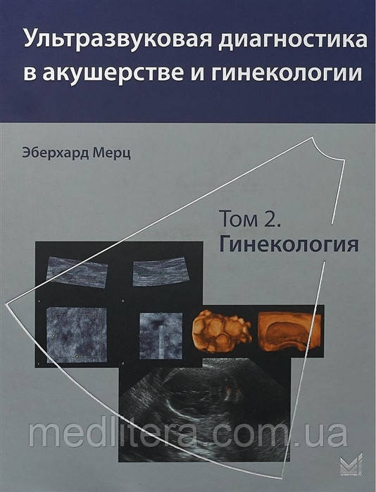 Мерц Е. Ультразвукова діагностика в акушерстві та гінекології. Том 2. Гінекологія