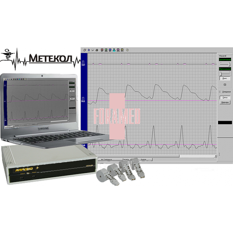 Спірограф. Діагностичний комплекс «КАРДІО+»