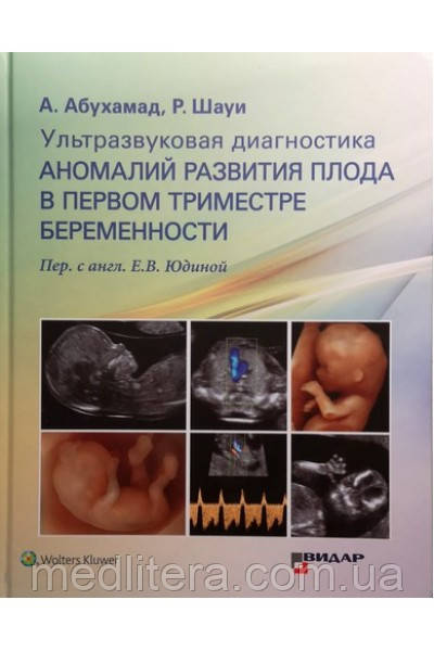 Абухамад А., Шауи Р. Ультразвукова діагностика аномалій розвитку плода в першому триместрі вагітності