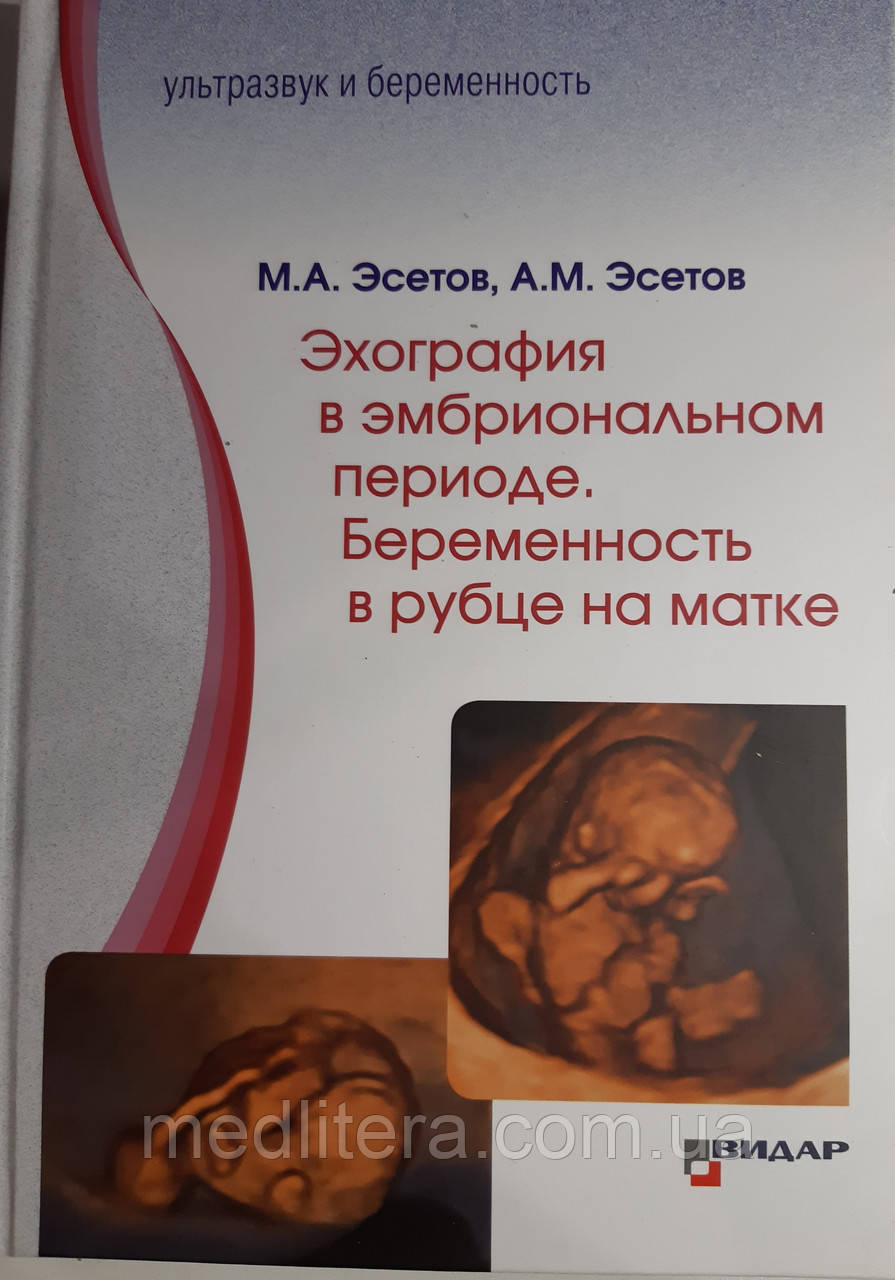 М. А. Эсетов, А. М. Эсетов. Ехографія в ембріональному періоді. Вагітність у рубці на матці 2020 рік