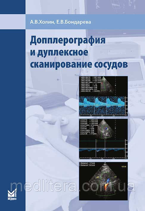 А. В. Холін Доплерографія і дуплексне сканування судин