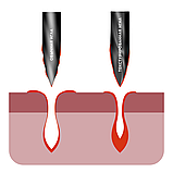 Текстуровані голки 1R(A) 0,3 для татуажу, фото 2