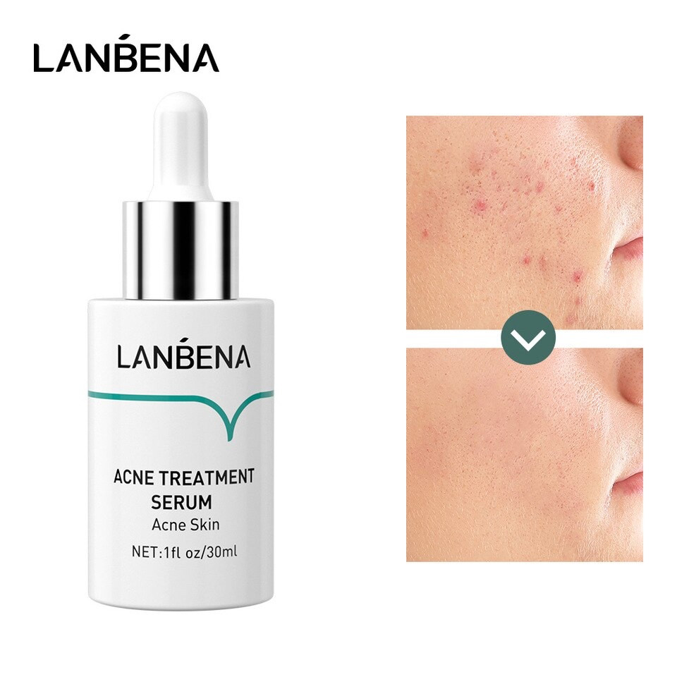 Lanbena Oligopeptide Acne Treatment Serum заспокійлива-протизапальна сироватка з олігопептидами