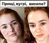 Гель-маска холодного гідрування, фото 3