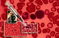 Діагностика живої краплі крові+ «ОБЕРОН»
