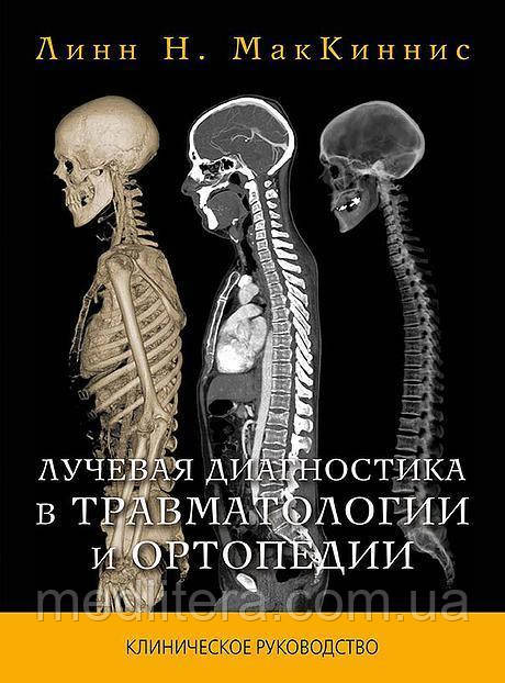 Лінн Н. МакКиннис Променева діагностика в травматології та ортопедії