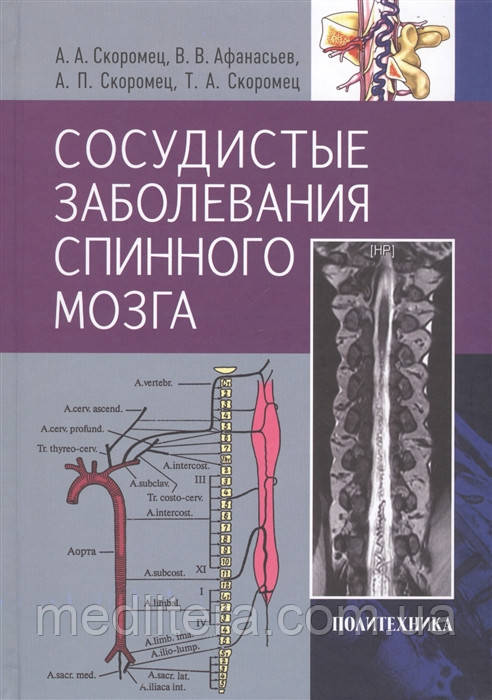 Скоромець А., Афанасьєв Ст. Судинні захворювання спинного мозку. Керівництво для лікарів