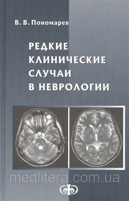 Пономарьов Ст. Рідкісні клінічні випадки в неврології. Керівництво для лікарів 2020 рік