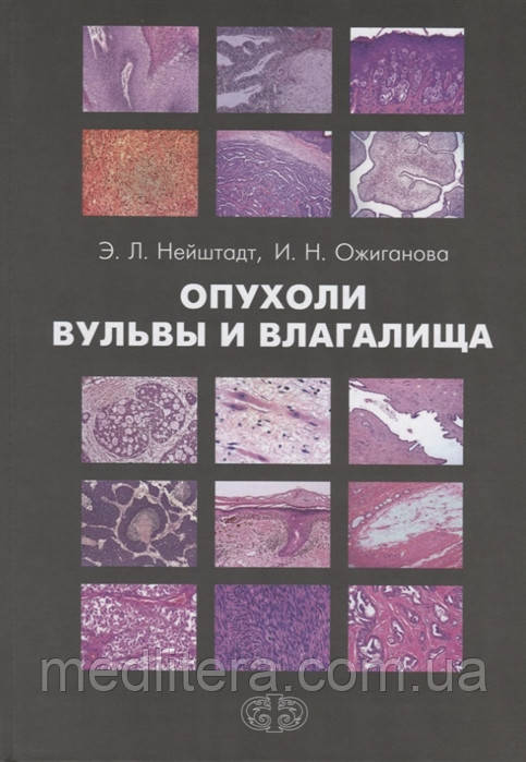 Нейштадт Е., Ожиганова В. Пухлини вульви і піхви