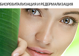 Біоревіталізація (екструнне зволоження й омолодження), фото 3