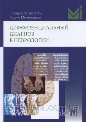 Мументалер М., Бассетти К., Диференціальний діагноз в неврології 4-е видання