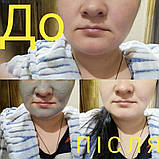 Гель-маска холодного гідрування, фото 2