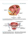 Раз Ш. Атлас реконструктивної хірургії піхви, фото 9