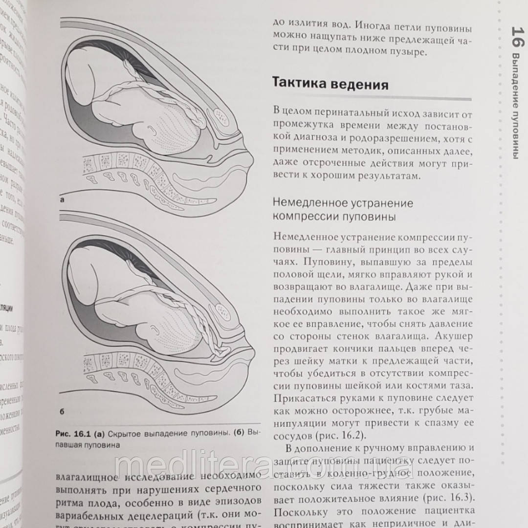 Томас Ф. Баскетт, Эндрю А. Калдер Оперативное Акушерство Манро.
