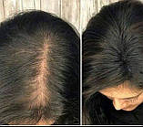 Маска проти випадіння волосся. Крок 4, фото 7